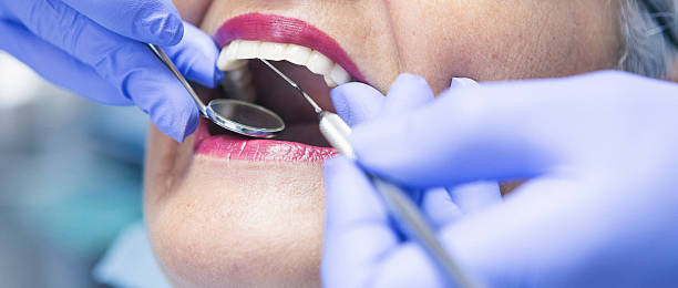 Best Emergency Tooth Extraction in Paris, KY
